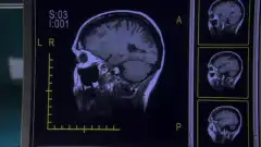 Доктор Хаус 3 сезон 22 серия